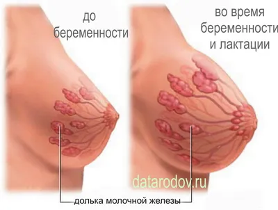 набряк грудей під час вагітності