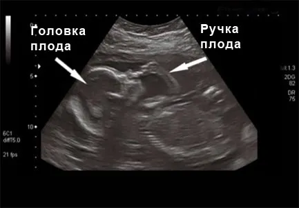 вагітність 21 тиждень