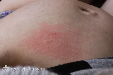20 тиждень вагітності узі