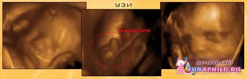 вагітність 28 тижнів фото