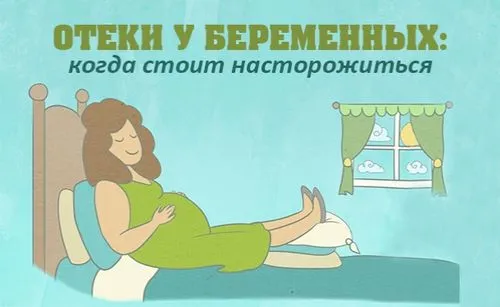набряки під час вагітності