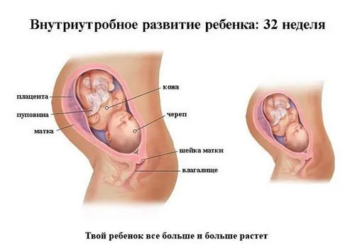 набряки на 32-му тижні вагітності