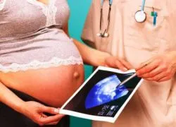 21 тиждень вагітності узі