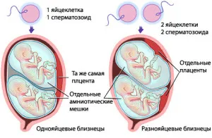 багатоплідна вагітність причини