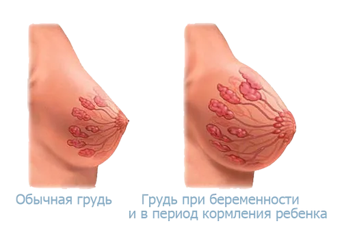 вагітність без ознак