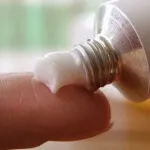зовнішній геморой у вагітних лікування