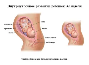 застуда на 32-му тижні вагітності застуда на 32-му тижні вагітності