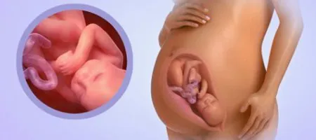 деяких