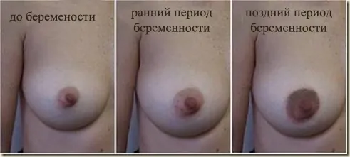 сухість сосків під час вагітності