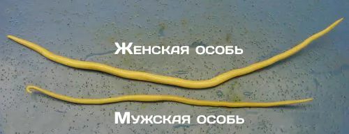 глисти у вагітних лікування