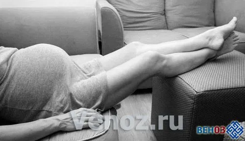 варикоз при вагітності варикозне розширення вен статевих губ матки паху профілактика як лікувати