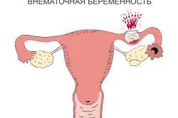 21 тиждень вагітності біль внизу живота