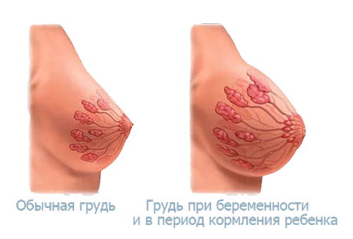 набряк грудей під час вагітності, набухає груди вагітність коли час місяць тиждень чому вірна ознака який термін починає через завжди чомусь набухає груди вагітність коли час місяць тиждень чому вірна ознака який термін починає через завжди чомусь
