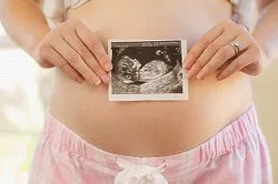 білі виділення на 32 тижні вагітності білі виділення на 32 тижні вагітності
