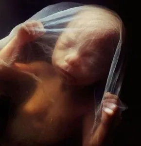 вагітність 18 тижнів фото, 18 тиждень вагітності вагітність 18 тижнів фото
