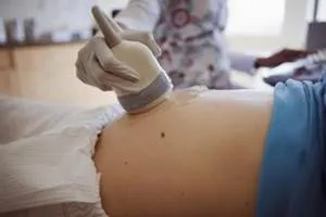 як виявляється завмерла вагітність на ранніх термінах