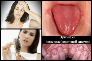 рекомендації