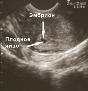 3 тиждень вагітності після зачаття