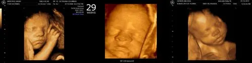 29 тиждень вагітності вага жінки