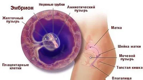 5 тиждень вагітності узі