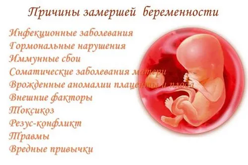 завмерла вагітність наслідки