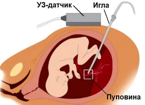 вагітність 10 11 тижнів