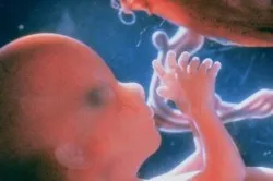 маловоддя у вагітних лікування маловоддя у вагітних лікування