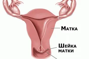 ерозія шийки матки після вагітності