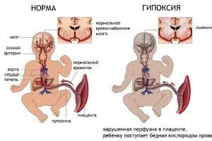 чи можна курити траву під час вагітності