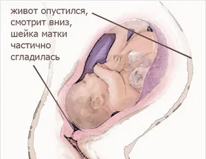 коли опускається живіт у вагітної