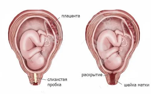 як відходить пробка при вагітності