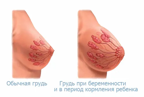 зміна сосків під час вагітності, зміна грудей при вагітності зміна сосків під час вагітності