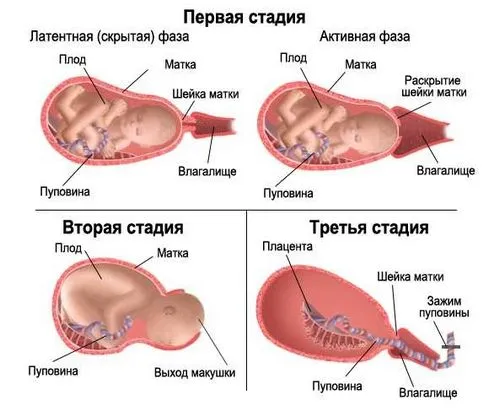 процес пологів дитину