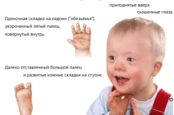 перший по узі