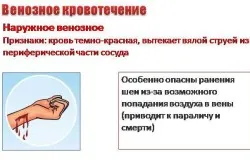 внутрішня кровотеча при вагітності, про склад крові про склад крові
