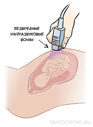 як підготуватися до узі під час вагітності