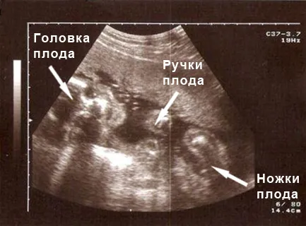 узі 24 тиждень вагітності термін малюк який