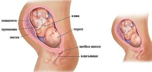 8 місяць вагітності виділення