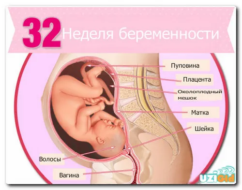 узі на 32-му тижні вагітності