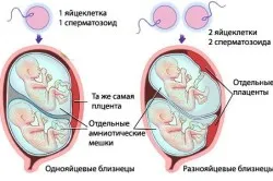 як протікає вагітність, перший по підлозі перший по підлозі