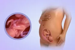 21 тиждень вагітності виділення з грудей 21 тиждень вагітності виділення з грудей