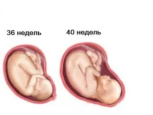 опущений живіт при вагітності