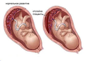 триместри вагітності триместри вагітності