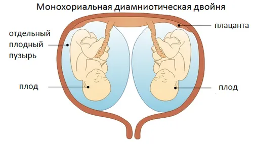 викидень