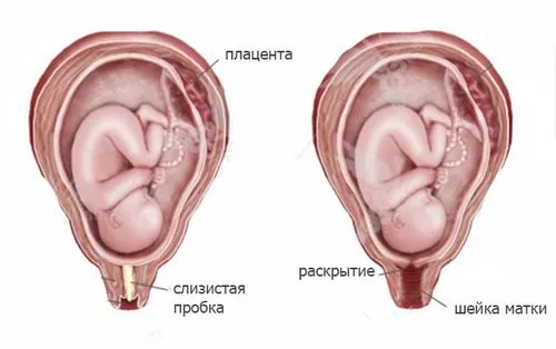 як довго відходить пробка у вагітних