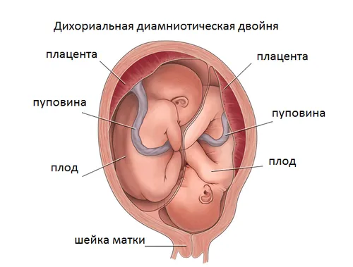ознаки вагітності