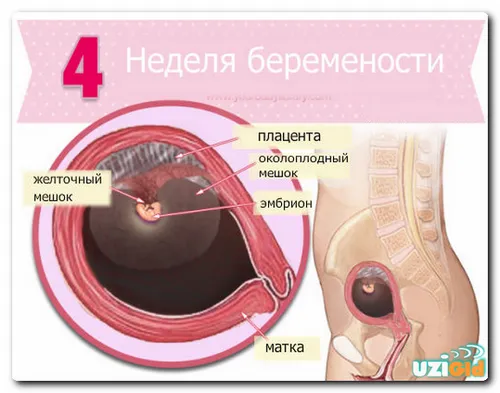 4 тиждень вагітності узі