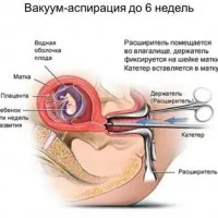 може