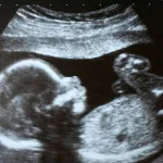 все про 24 тиждень вагітності