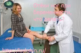 набряки ніг при вагітності що робити